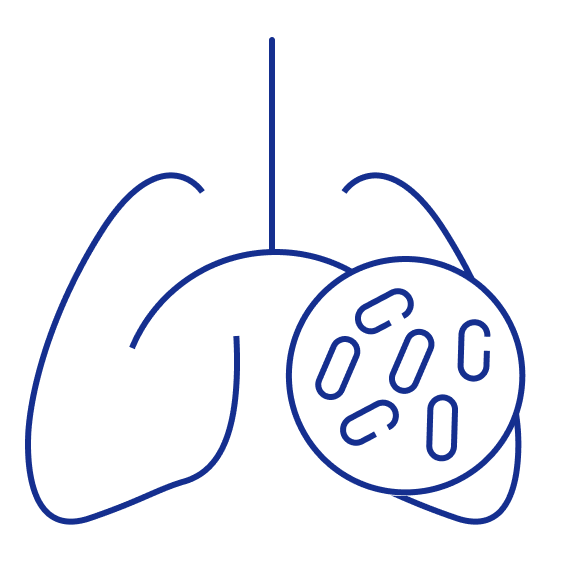 Tuberculosis